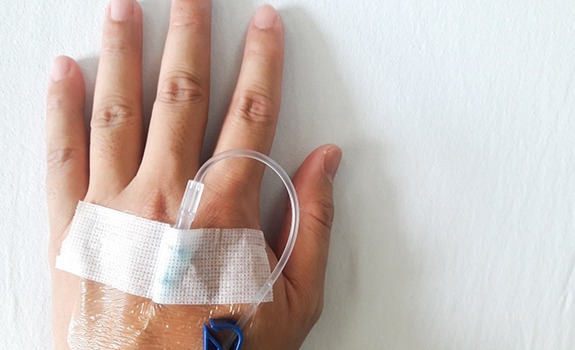 Patient’s hand, prepared for IV sedation