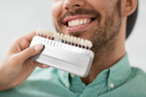 Close-up of man smiling while dentist uses tooth color guide for color-matching