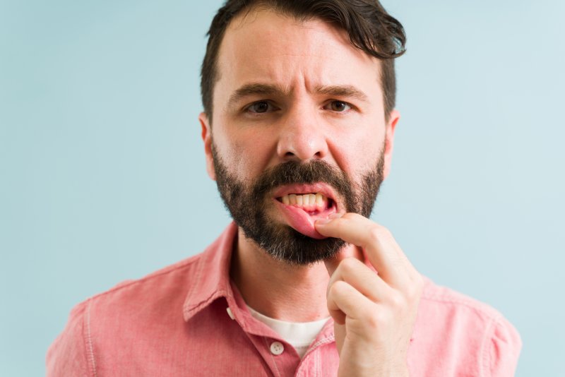 A closeup of a man with inflamed gum tissue